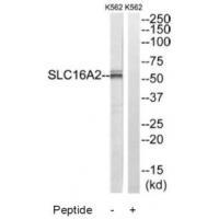 SLC16A2 Antibody