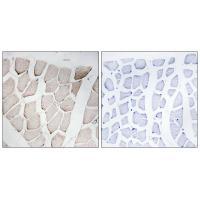 MYOM1 Antibody
