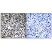 MPRIP Antibody