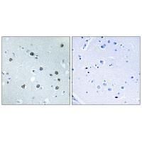 MYO1D Antibody