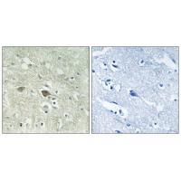 NDUFV3 Antibody