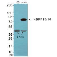 NBPF1/9/10/12/14/15/16/20 Antibody
