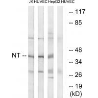 NT Antibody