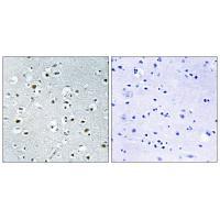 PPRC1 Antibody
