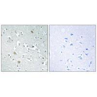 PLA1A Antibody
