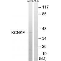 KCNK15 Antibody