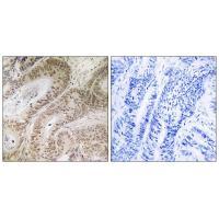 RDM1 Antibody