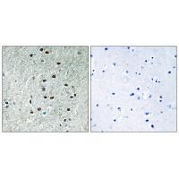 REXO1 Antibody