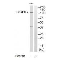 PPP2R5A Antibody