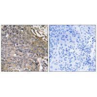 SH2D1B Antibody