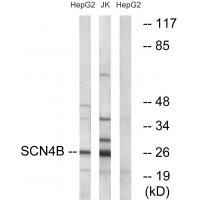 SCN4B Antibody