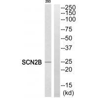 SCN2B Antibody