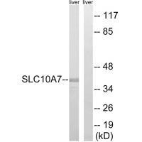SLC10A7 Antibody
