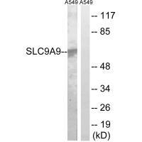 SLC9A9 Antibody