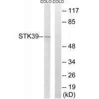 STK39 Antibody