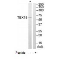 TBX18 Antibody
