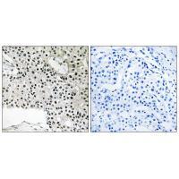 TCEAL4 Antibody