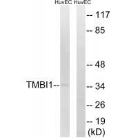 TMBIM1 Antibody