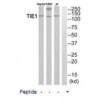 TIE1 Antibody