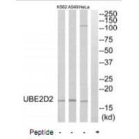 UBE2D2 Antibody