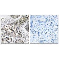 USP6NL Antibody