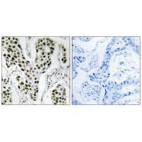 ZC3H4 Antibody