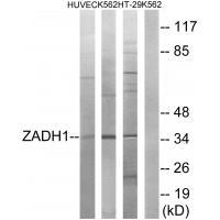 ZADH1 Antibody