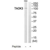 TAOK3 Antibody