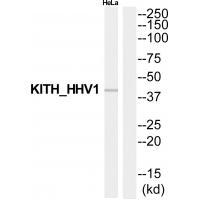 KITH_HHV1 Antibody