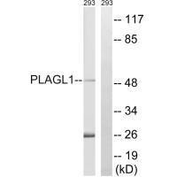 PLAGL1 Antibody