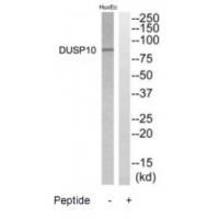 DGKB Antibody