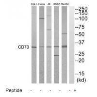 CD70 Antibody