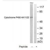 Cytochrome P450 4A11/22 Antibody