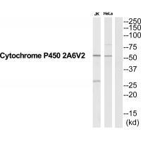 CYP2A6V2 Antibody