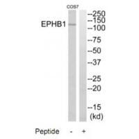 EPHB1 Antibody