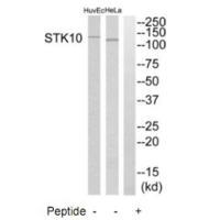 STK10 Antibody