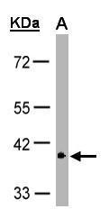 GPR146 Antibody
