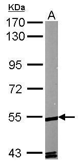 ROR alpha Antibody