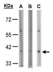GPR91 Antibody