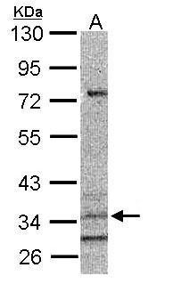 CysLT1 Receptor Antibody