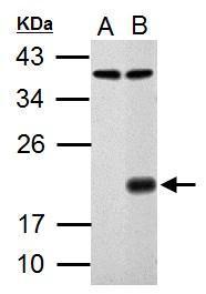 p21 Antibody