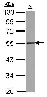 CD4 Antibody