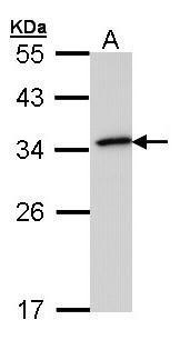 NQO1 Antibody