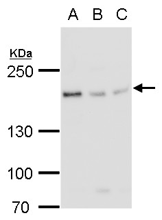 BLM Antibody