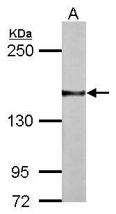 NCAM Antibody