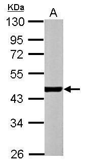 alpha Actin (cardiac muscle) Antibody