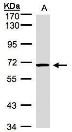 ACVRL1 Antibody
