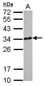 CLTA Antibody