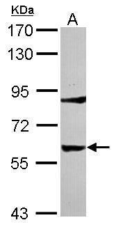Tyrosine Hydroxylase Antibody