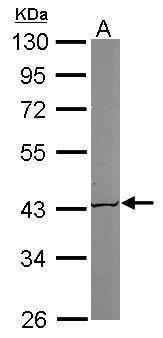 ACAT1 Antibody